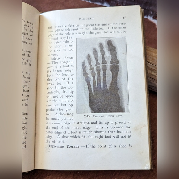 Personal Hygiene by Frank Overton 1913 Antique Hardcover Book - Picture 15 of 16